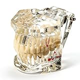 Uadme Modelo de Demostración Dental de Dientes Transparente Desmontable, Fantoma Dental Estándar para Enseñanza, Cuidado Bucal