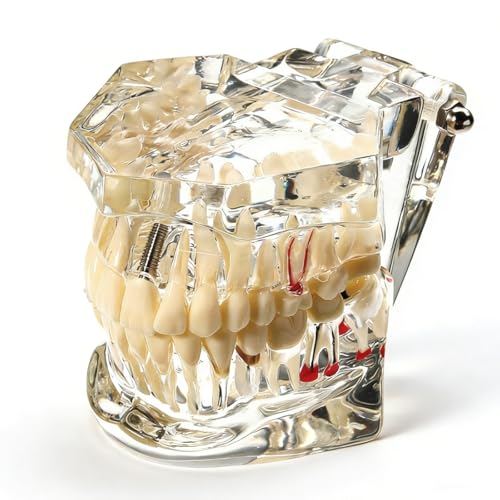 Uadme Fantoma Dental, Modelo de Demostración Dental, Modelos de Dentadura Articulada, Modelo de Dientes Desmontable, para Enseñanza Dental, Cuidado Bucal