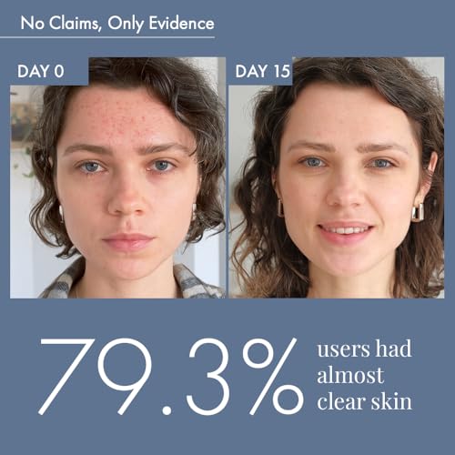Image of ThriveCo Acne-Free Sun Defense Kit | Sunscreen (30ml), Anti-Acne Serum (10ml) & Face Wash (25ml) | Treats Acne, & Acne Marks | SPF 50 PA++++ | Zero White Cast | Travel-Friendly | For Men and Women