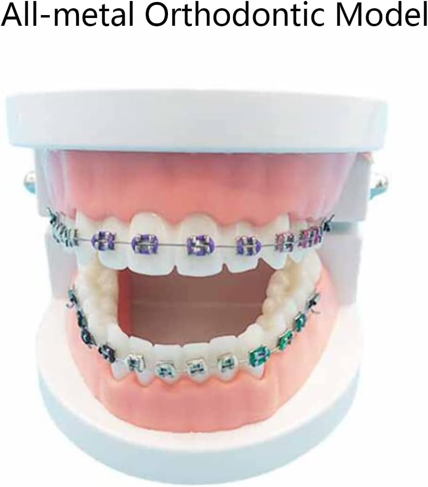 シミュレーション口腔歯モデル - 歯科矯正デモンストレーションモデル - 金属ブラケット付き歯科歯治療モデル、アーチワイヤー説明モデ
