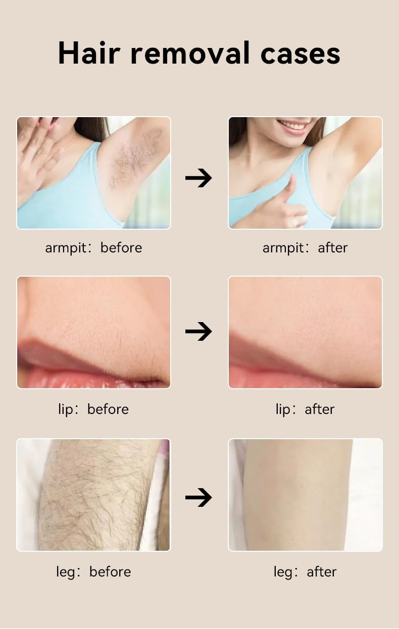 Professional Hair Removal for Men and Women Device.Hair Removal for Nearly Painless.Fast Full Body Hair Removal
