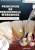  Principios de Periodoncia workbook: De lo teórico a lo práctico (Spanish Edition)