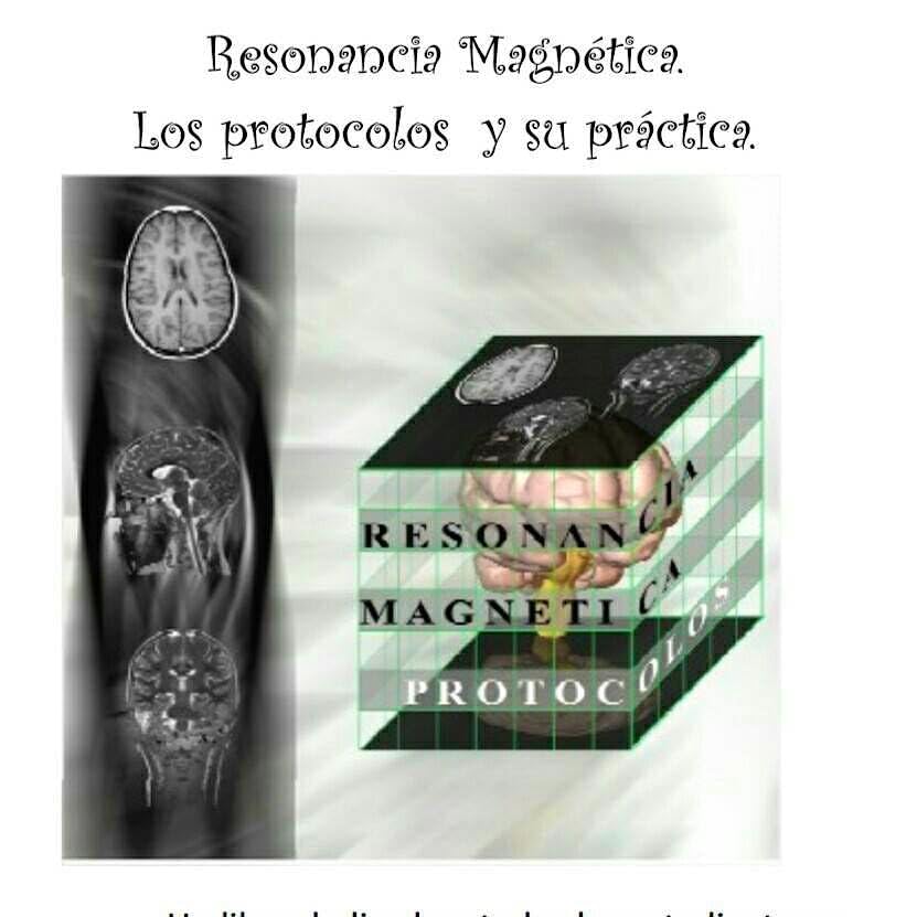 Resonancia Magnética. Protocolos