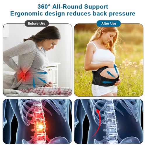 AUYAO Pregnancy Belly Band Maternity Belt Abdominal Binder Maternity Belt, Elastic Pregnancy Support Belt Adjustable Pregnancy Belly Band Pelvic Girdle Belt for Pregnancy Support(Black-XL) - Image 4