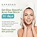 Exposed Skin Care, Acne Facial Cleanser with 0.5% Salicylic Acid for Sensitive and Acne-Prone Skin – Gentle Daily Face Wash for Breakout, Blackhead and Excess Oil – Natural, Non-toxic and Cruelty Free