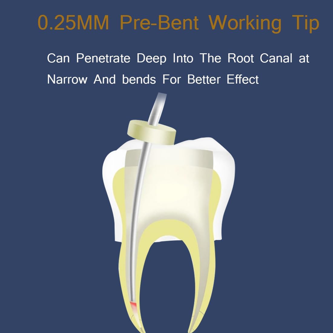 Diagram showing the 0.25MM pre-bent working tip penetrating a root canal
