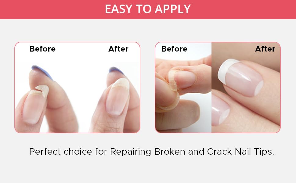EXCUSE ME Professional Nail Repair Kit for Broken Cracked Split and Weak Nails. Easy to Use and Apply. Life saver nail Kit for Quick Fix Solution