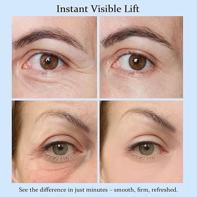 InfiniteLift - Gel Tensor Rejuvenecedor De Ojos(Juego de 20 g)