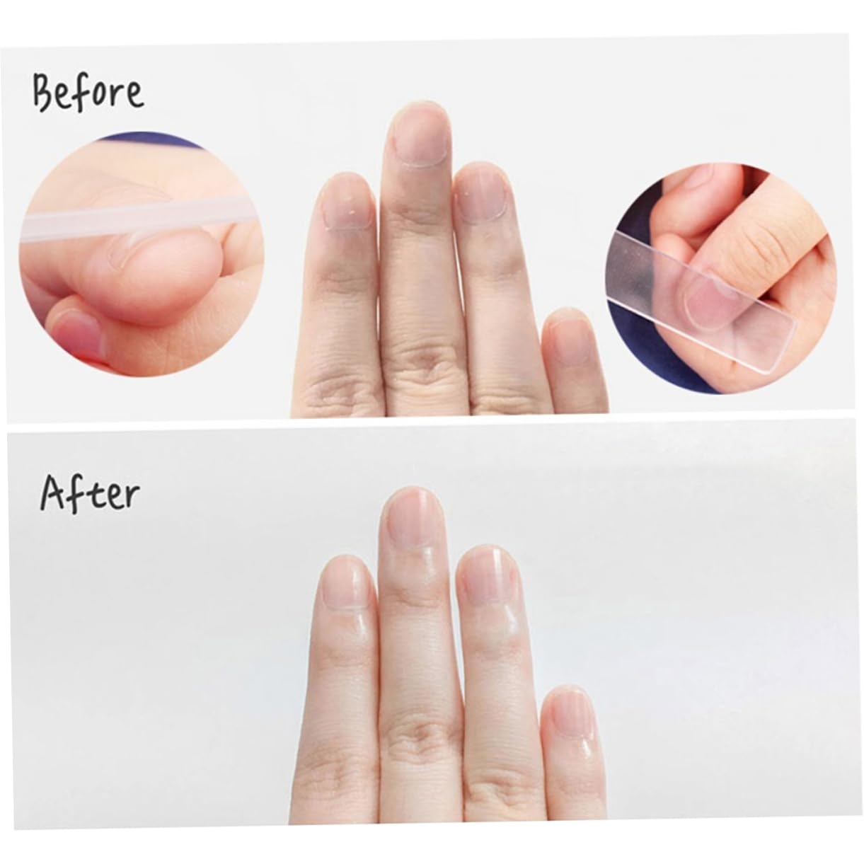 Healvian 6pezzi Unghie Con Manico Trasparente e Custodia Strumenti Per Manicure Professionale Per Trattamenti Art Design Compatto e Portatile