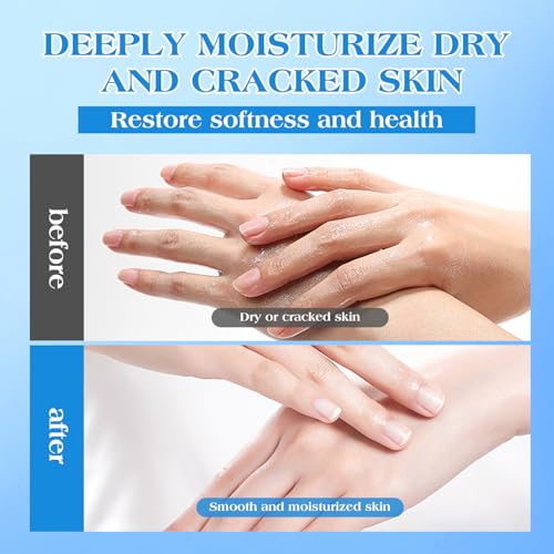 42% Urea Cream with 2% Salicylic Acid & 5% Vitamin E - Intensive Moisturizer Foot & Hand Repair Cream for Dry, Cracked Skin - 150g – Bild 3