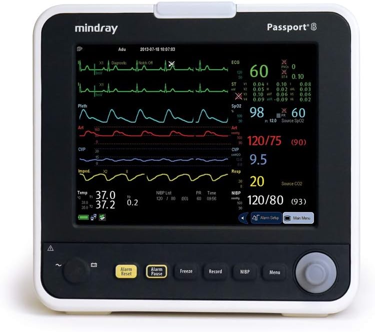 Mindray 6104F-PA00001 Passport 8 Patient Monitor