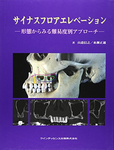 無料電子書籍 アプリ サイナスフロアエレベーション―形態からみる難易度別アプローチ バイ