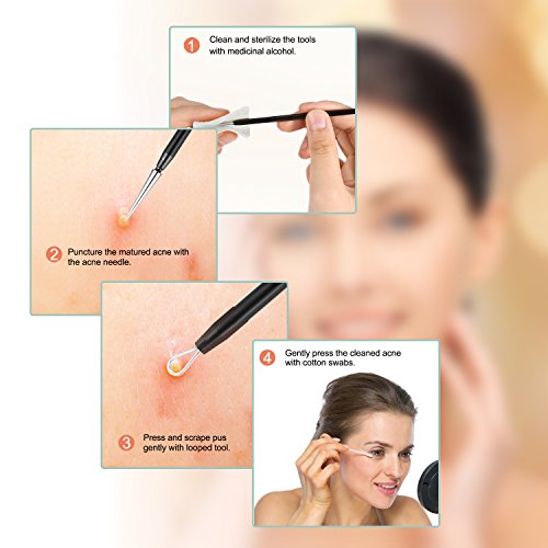 Blackhead Removal Tool, Pimple Comedone Extractor Tool Free Facial Tools for Facial Acne and Treatment for Blemish with Face Cleaner Skin Care & Stainless Steel - Thumbnail 3