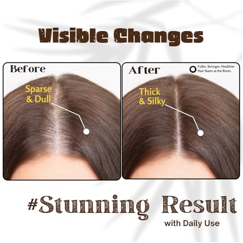 Gutaderme Rosemary Oil for Hair Growth 3.4oz — view 4