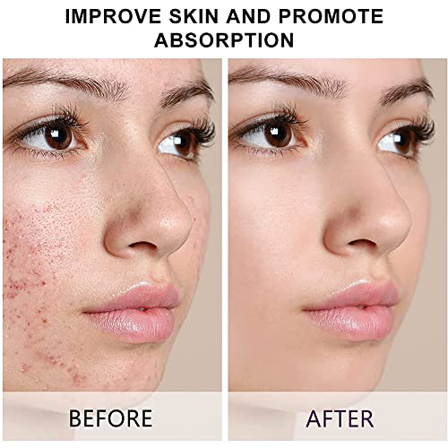 Dermaroller,Dermaroller Microneedling Derma Roller...