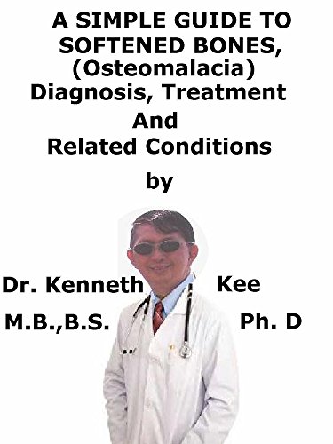 A Simple Guide To Softened Bones (Osteomalacia) Diagnosis, Treatment And Related Conditions (A Simple Guide to Medical Conditions)