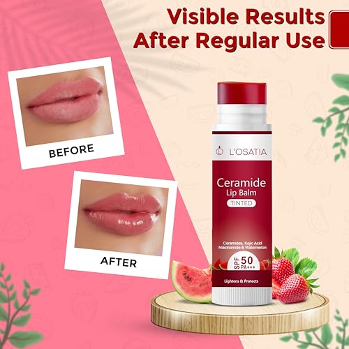 Image of Tinted Lip Balm SPF 50 PA+++ | Brightening Lip Care with Niacinamide, Kojic Acid & Ceramide | Moisturizing for Dark & Pigmented Lips (5g)