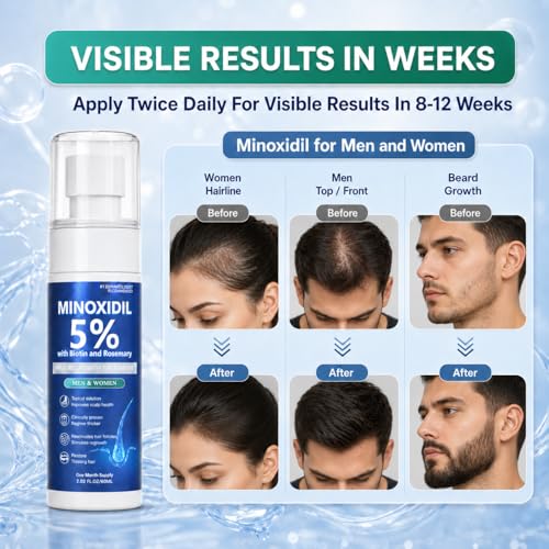 Image of Minoxidil for Men and Women, Hair Growth Serum with Biotin, Rosemary and Batana for Hair Beard Regrowth Treatments Extra Strength Hair Loss Solution, Clinically Proven to Regrow Thicker, 60ML