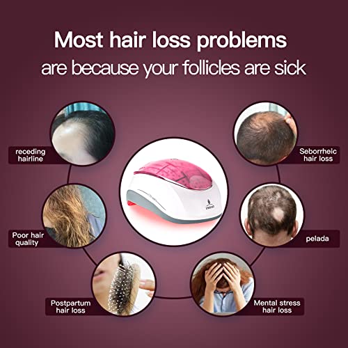 Ihelmet Laser Hair Growth System, Hair Regrowth Helmet & Laser Cap (Fda Cleared), Hair Loss Treatment For Men And Women, Low Level Laser Therapy For Hair Growth, Anti-Thining Treatment Pink, 160Pro #TOP6