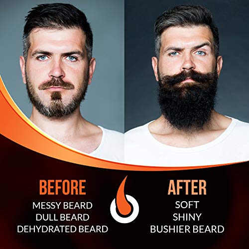 Beard Growth Oil - 1Fl Oz - Growing Serum That Softens & Strengthens Beards and Mustaches - Facial Hair Treatment Treatment Infused with Biotin Capilia Longa Niacinamide and 100% Natural Ingredients - Image 4