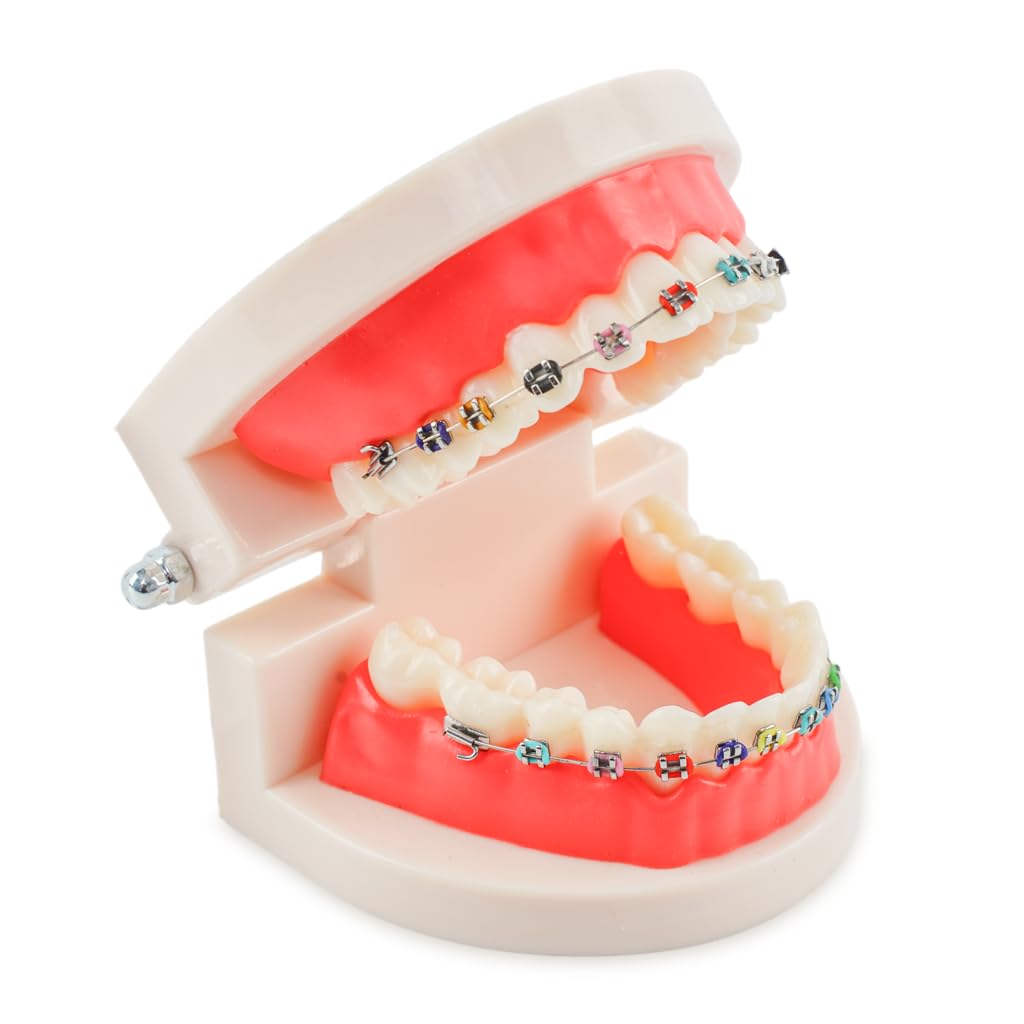 HANNEA® Dental Orthodontic Teeth Model with Colorful Braces for Training and Oral Education-picture-10