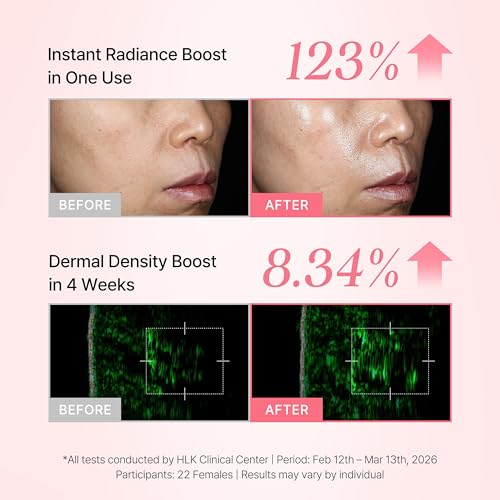 Image of PeachMicrobiome 10 Million Exosome Cream with 3% Niacinamide & 5% Squalane, Face Moisturizer for Sensitive Skin, Barrier Support, Lightweight Texture, Glass Skin Finish (1.69 fl oz)