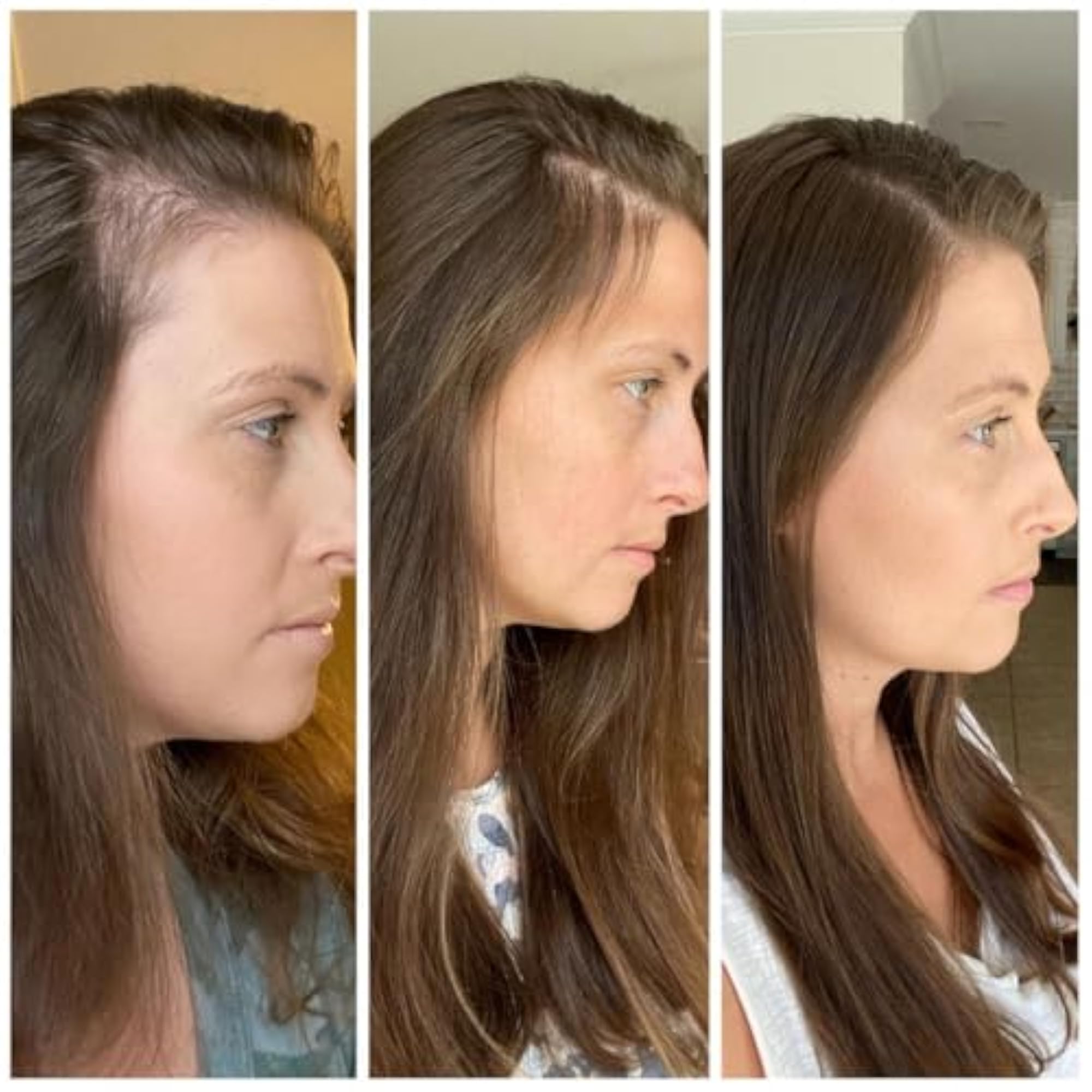 Hairline Powder, Quick Touch-Up Solution