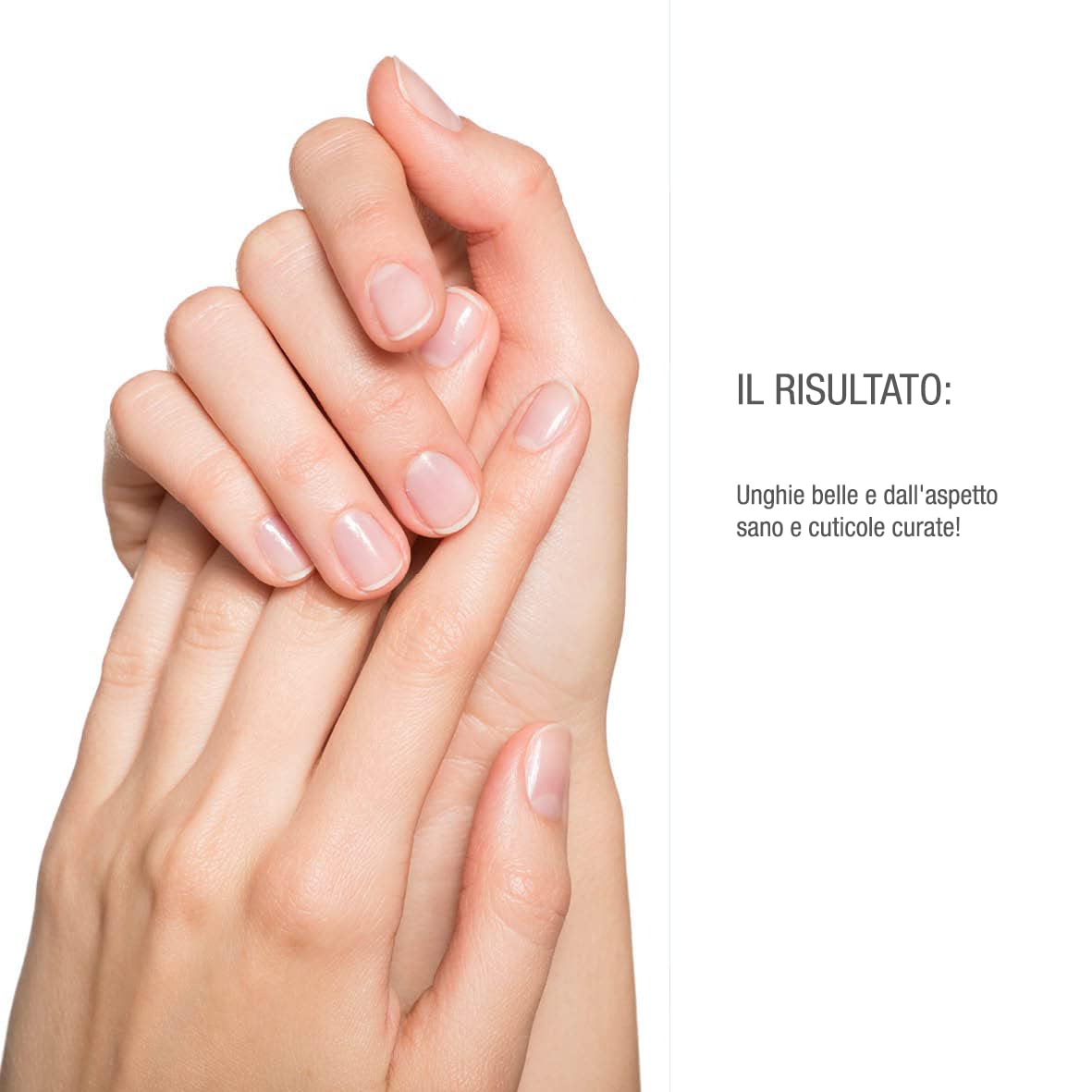 vitabay Shea Nail Butter, crema per unghie con biotina/vitamina H e burro di karitè contro unghie fragili e cuticole secche e screpolate, Burro Di Karité Per Le Unghie, 20 ml (confezione da 1)