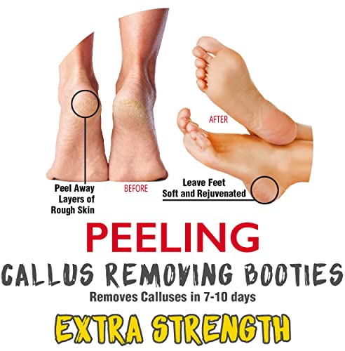 Onyx Professional 74746 Foot Peel Mask Callus Remover (2 Pack) Dead Skin Remover thumb #1