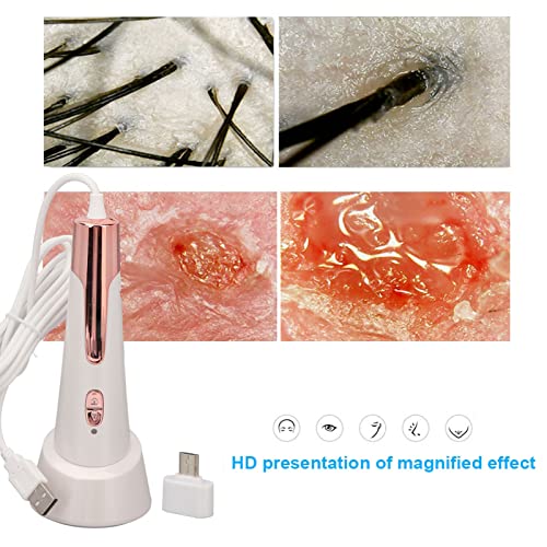 Analizzatore di Pelle 80X Professionale 2MP LED a 3 Colori Microscopio Cutaneo Portatile
