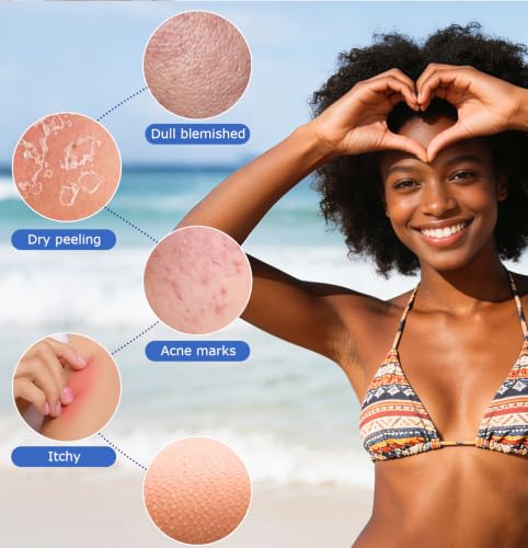 Image of UJFQBH African Net Sponge Authentic, A Soft Yet Powerful Exfoliating Body Scrubber, Dries Quickly, and Gradually Transforms Rough Skin into Smooth 3 Pieces Rose red, Yellow, Green
