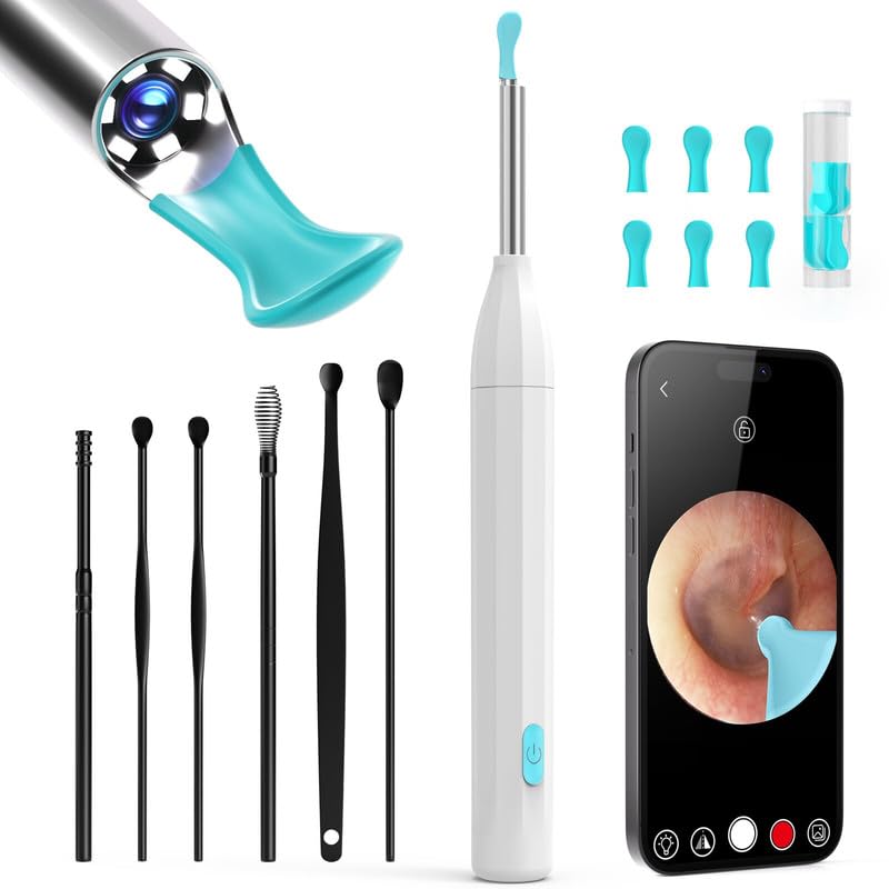 Ear Wax Removal with Camera and Light: AILE Rechargeable Ear Wax Removal Tool: 1080P Ear Scope: Ear Cleaning Kit for Kid/Adult: Compatiable with iOS & Android (White)