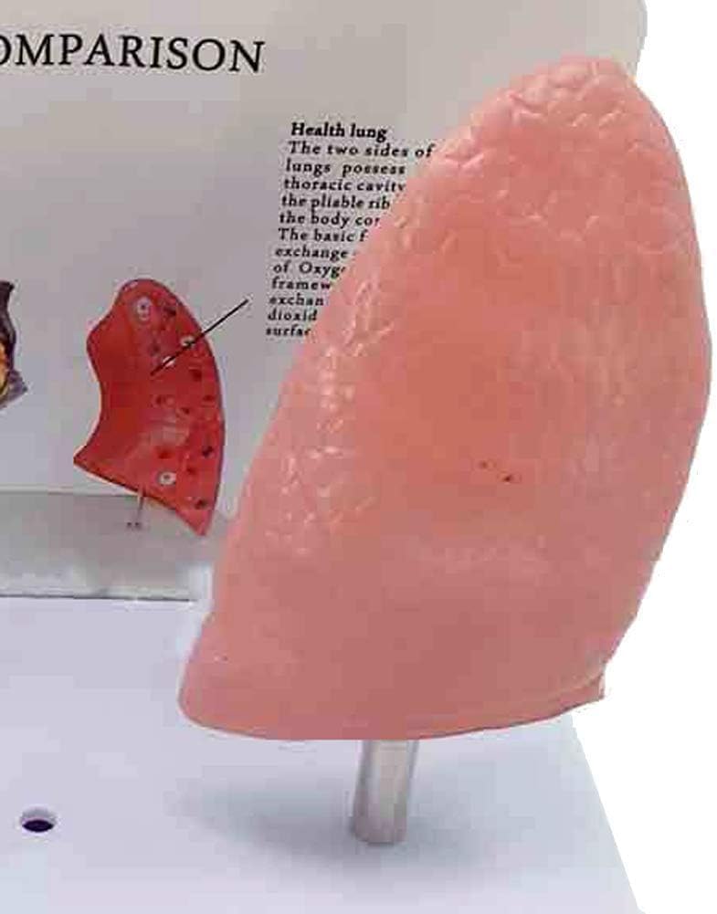 Anatomía Modelo anatómico Ensamblaje Anatómico Los pulmones Pulmón Patología Normal Modelo anatómico Aula para la educación del Paciente para la Escuela,Educación