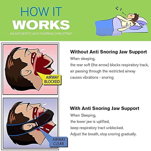 Anti Snoring Chin Strap Stop Snoring Anti Snoring Devices - Anti Snore Chin Strap, Snoring Solution, Anti Snore Device, Adjustable Chin Strap For Snoring, Cpap Chin Strap To Keep Mouth Closed #TOP7