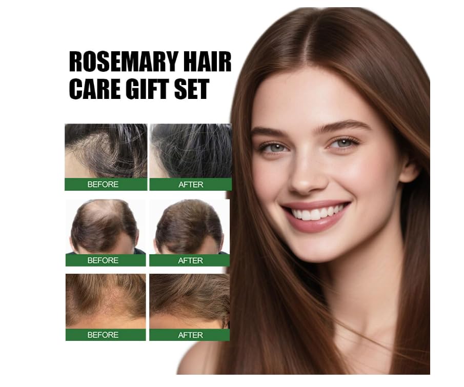 Rosemary Hair Care Gift Set & Hair Growth Kit with Spray ，& Roller Hair Repair for Strengthen & Nourish - Natural Treatment with Jojoba Oil for Damaged Hair Care Suitable for Women and Men