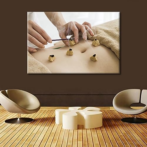 Image of TUMOVO 1 Panels Moxibustion Canvas Wall Art Moxa Moxibustion Posters Paintings for Wall Decorations Nosocomium Artwork Canvas Photo Stretched and Framed Ready to Hang (24 inch Wx36 H)