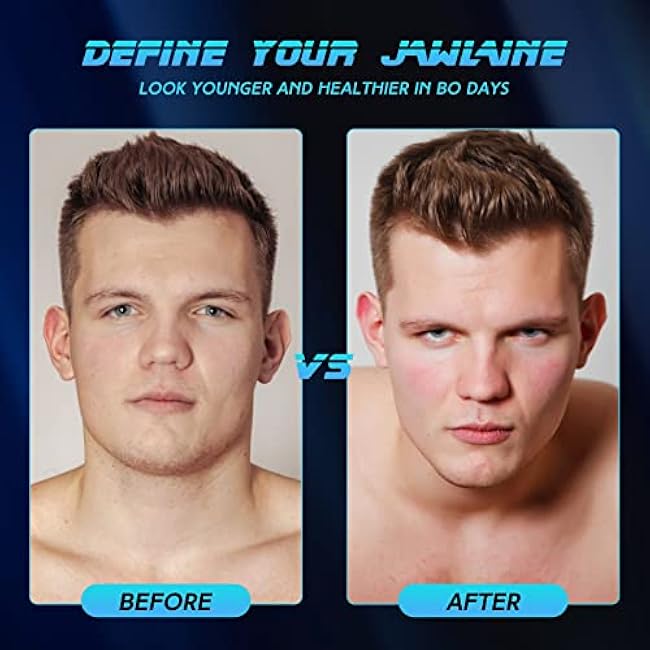 Jaw Exerciser for Men & Women ¨C 3 Resistance Levels (6 pcs) Silicone Jawline Exerciser Tablets ¨C Powerful Jaw Trainer for Beginner, Intermediate & Advanced Users