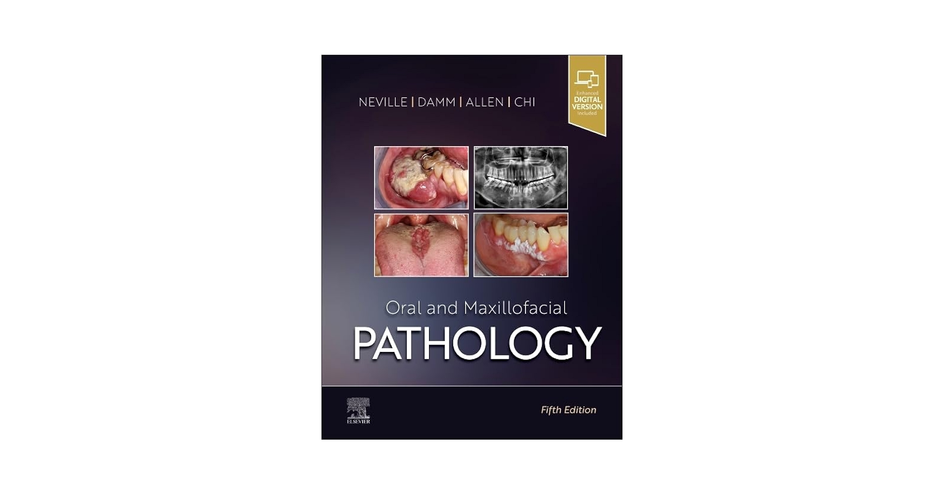 健康・医学 ContemporaryOralandMaxillofacialSurgery Contemporary Oral and Maxillofacial Surgery: 9780323018876
