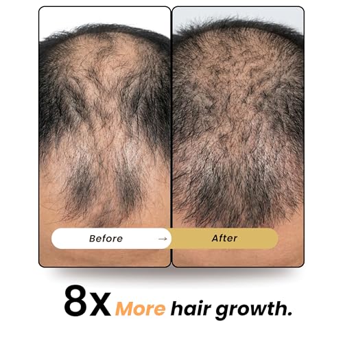 Image of FOLLIWISE Hair Growth Capsules for Men | Hair Fall Control Supplement with Veg Collagen, Biotin, DHT Blocker, Essential Amino Acids, Vitamins & Minerals | Stronger & Healthier Hair | 60 Veg Capsules