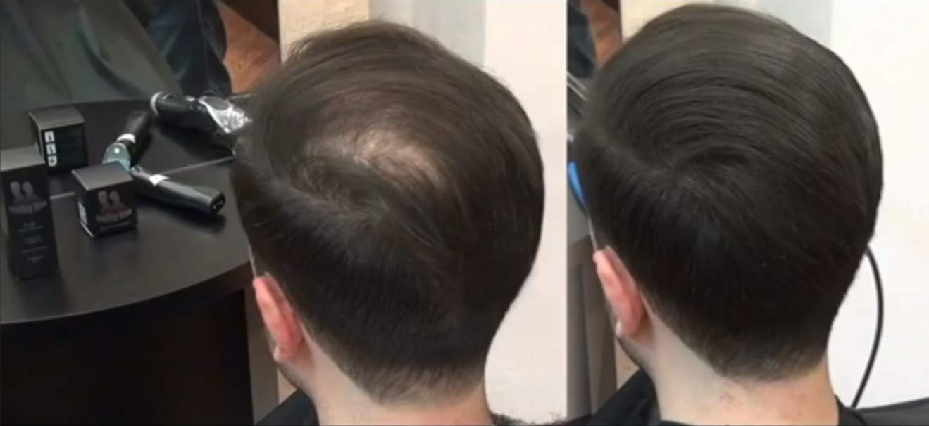 Set de pelo