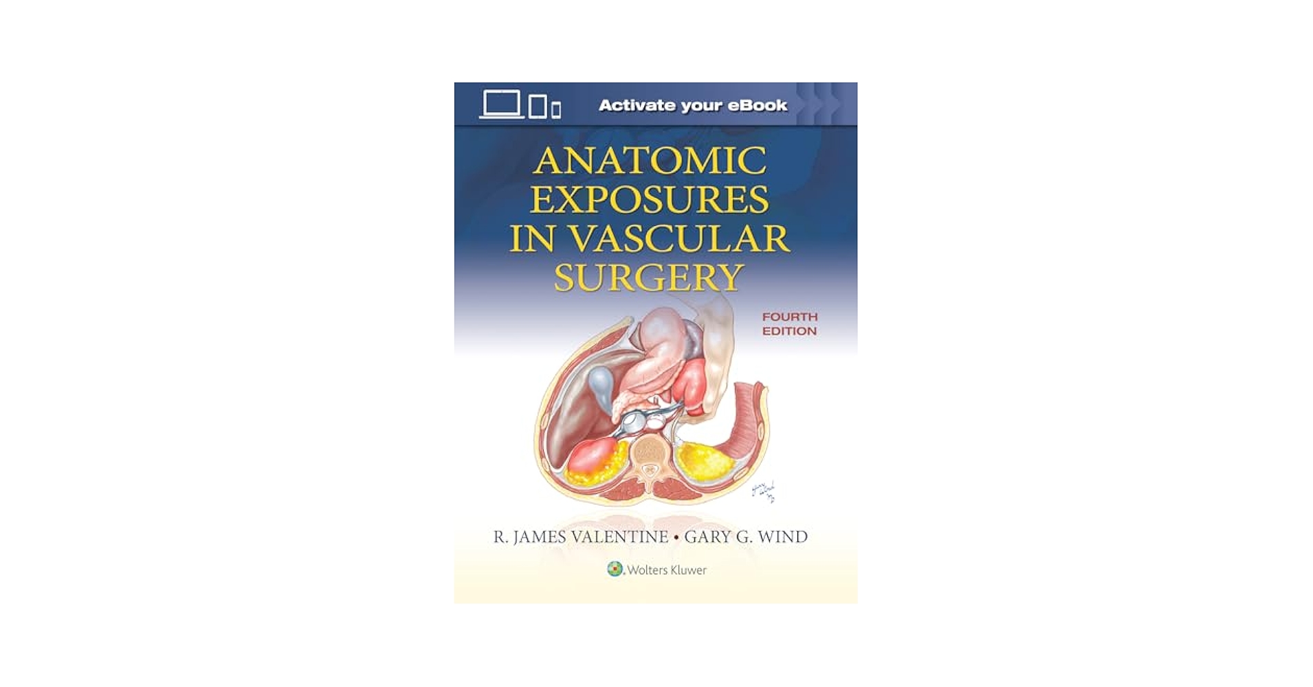 健康・医学 ANATOMIC EXPOSURES IN VASCULAR SURGERY Anatomic Exposures in Vascular Surgery: 9781975152765