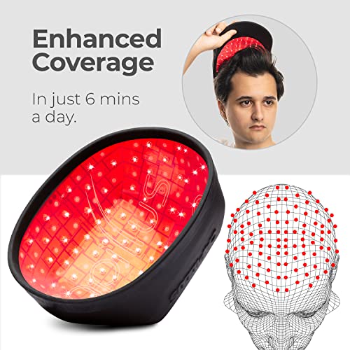 Capillus One Hair Growth Laser Cap, Fda Cleared Cold Laser Therapy Device Ideal For Thinning Hair, Laser Hat For Hair Growth For Men And Women To Treat Androgenetic Alopecia #TOP1