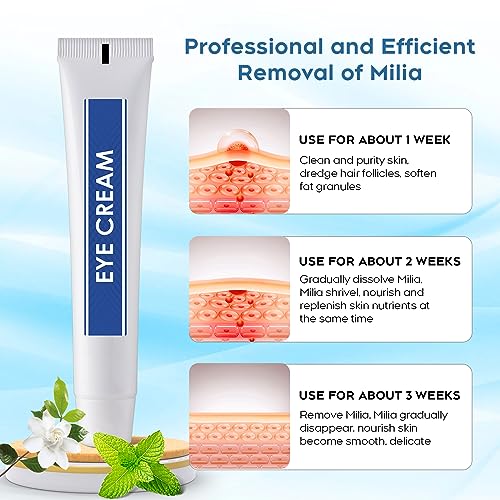 Milia Remover Eye Cream, Milia Spot Treatment Helps Dissolve And Reduce Milia