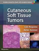Cutaneous Soft Tissue Tumors: 9781451192766: Medicine