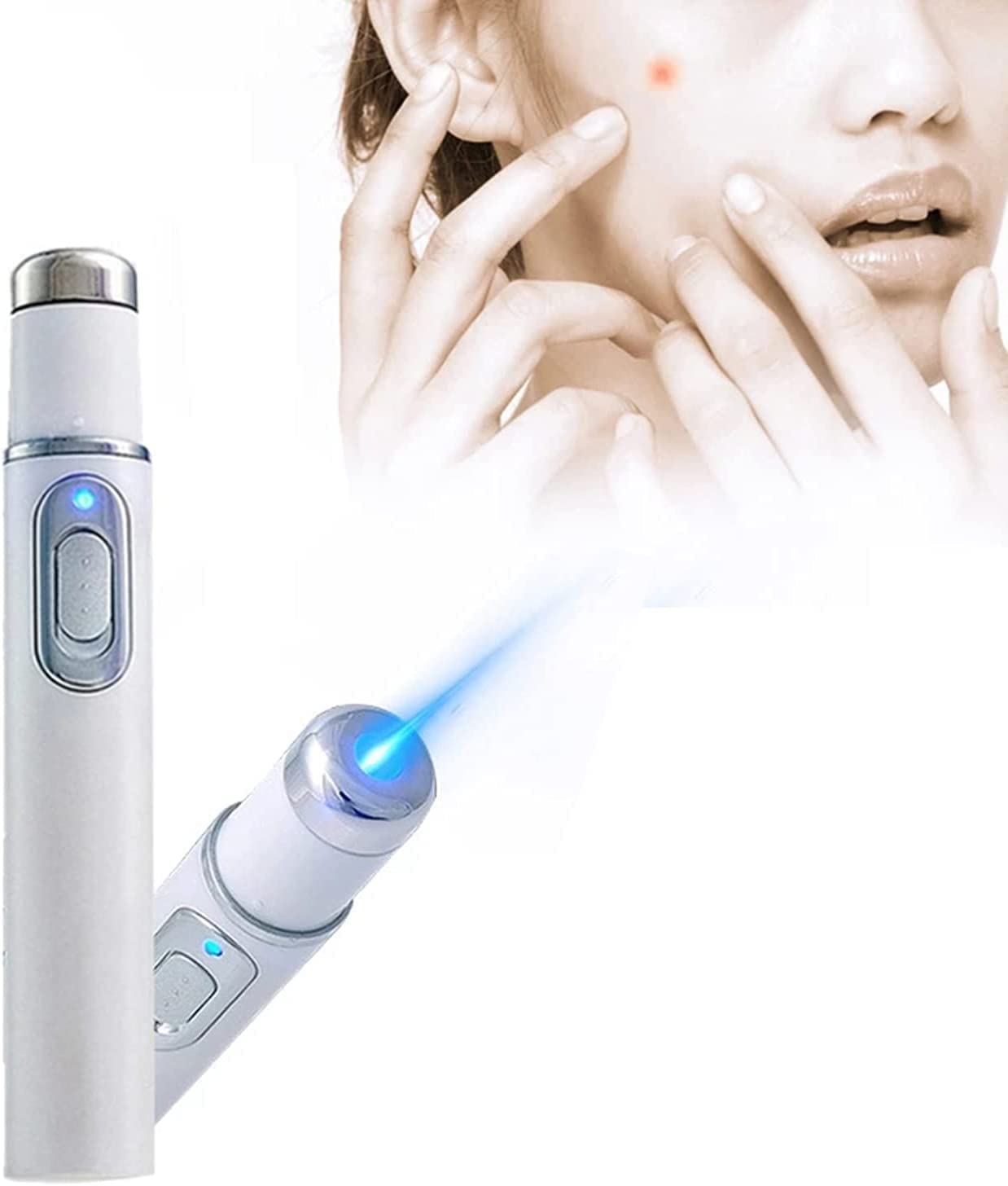 Buy FISHAW Acne Removal Device, Spider Veins Acne Laser Pen 415nm