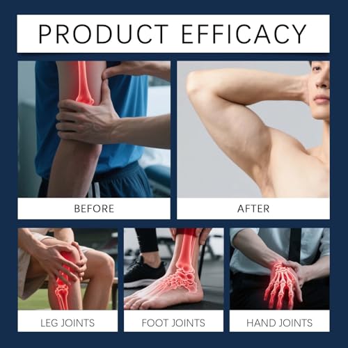 Crema Comfort Mirata, Crema Comfort Per Piedi E Nervi, Lozione Alla Capsaicina Con Arnica E Mentolo, Lozione Topica Lenitiva Per Muscoli E Articolazioni, Miscela Ad Assorbimento Rapido (8 Pz) - 3