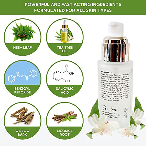Care Me Body Acne Clearing Treatment Serum with Salicylic Acid, Tea Tree Oil - Clear Acne, Pimples, Bumps on Buttocks, Thighs, Back, Chest; Repair Renew the Skin, 1.37 fl oz or 40 ml