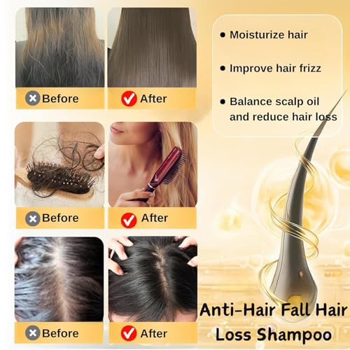 Image of Anti Hair Loss Shampoo,Remimpi Anti Hair Fall,Promote Hair Growth and Thickening & Strengthening Shampoo with Various Plant Extracts for All Hair Types (2PCS)