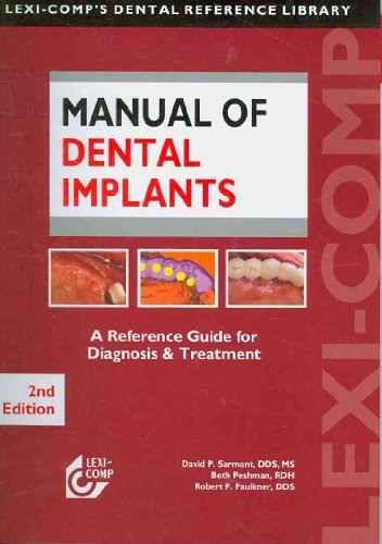 Manual of Dental Implants