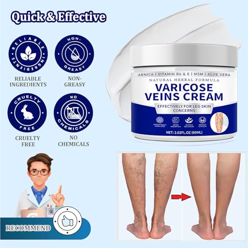 Save on Vivipop Varicose Veins Cream with Code G587HOC8 - Image 3